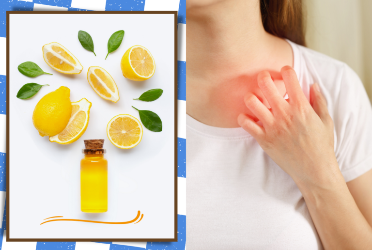 Home Remedies For Itching Skin