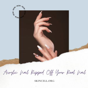 Acrylic Nail Ripped Off Your Real Nail - Skincell.org