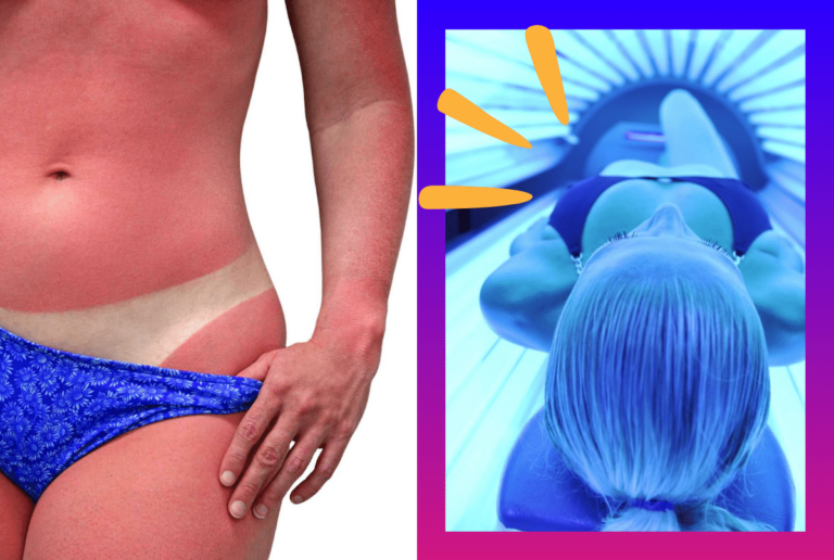 Can You Tan the Next Day If You Burn in a Tanning Bed?
