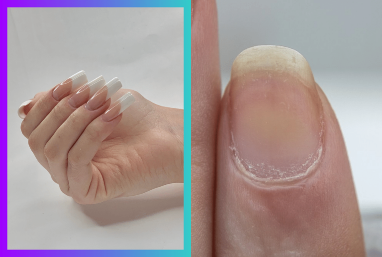 Why Do Dip Nails Turn Yellow?